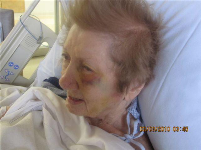 Peggy Marzolla, after suffering injuries in 2010. (Photo: Maureen Persi)